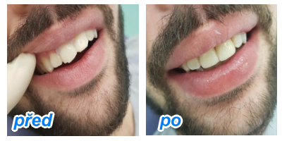 zubaři přijímají nové pacienty