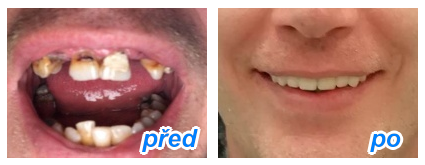 zubaři, kteří přijímají nové pacienty