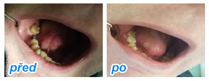 zubaři, kteří přijímají nové pacienty